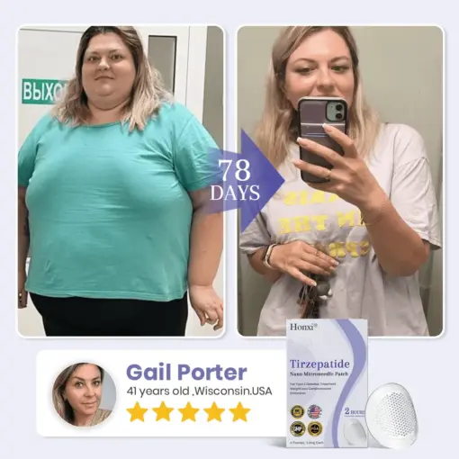 𝗛𝗼𝗻𝘅𝗶® 𝗡𝗜𝗗𝗗𝗞-𝗧𝗶𝗿𝘇𝗲𝗽𝗮𝘁𝗶𝗱𝗲 𝗡𝗮𝗻𝗼 𝗠𝗶𝗰𝗿𝗼𝗻𝗲𝗲𝗱𝗹𝗲 𝗣𝗮𝘁𝗰𝗵