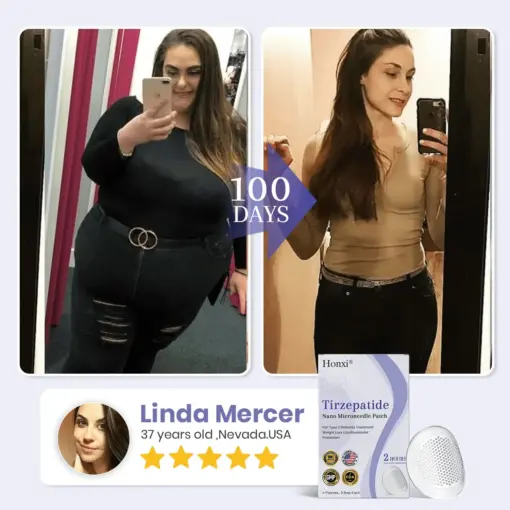 𝗛𝗼𝗻𝘅𝗶® 𝗡𝗜𝗗𝗗𝗞-𝗧𝗶𝗿𝘇𝗲𝗽𝗮𝘁𝗶𝗱𝗲 𝗡𝗮𝗻𝗼 𝗠𝗶𝗰𝗿𝗼𝗻𝗲𝗲𝗱𝗹𝗲 𝗣𝗮𝘁𝗰𝗵