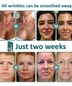Flysmus® Botox Jellyfish Venom Peptide Nanoliposome Sculpting Anti-Wrinkle Cream