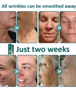 Flysmus® Botox Jellyfish Venom Peptide Nanoliposome Sculpting Anti-Wrinkle Cream