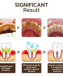 JEREMYTIS™ Ultra Whitening Mint Toothpaste