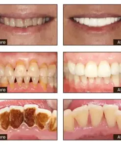 JEREMYTIS™ Ultra Whitening Mint Toothpaste