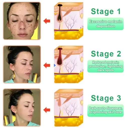 Jorondy® Purifying Exfoliating Gel