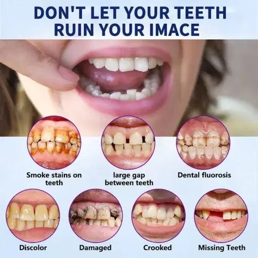 NESLEMY®-🦷Advanced Customized Full Denture Set