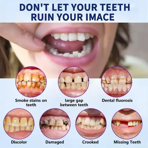 Neslemy™ - Premium Denture