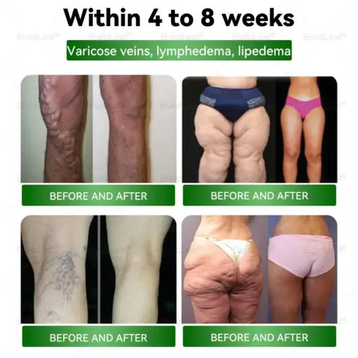 𝐁𝐮𝐢𝐥𝐝𝐋𝐞𝐚𝐟® 𝐓𝐢𝐫𝐳𝐞𝐩𝐚𝐭𝐢𝐝𝐞 𝐆𝐋𝐏-𝟏 𝐌𝐨𝐫𝐢𝐧𝐠𝐚 𝐒𝐥𝐢𝐦𝐦𝐢𝐧𝐠 & 𝐇𝐞𝐚𝐥𝐭𝐡 𝐁𝐨𝐨𝐬𝐭 𝐃𝐫𝐨𝐩𝐬
