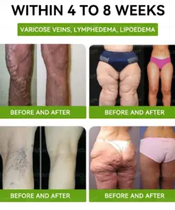 𝐁𝐮𝐢𝐥𝐝𝐋𝐞𝐚𝐟® 𝐆𝐋𝐏-𝟏 𝐓𝐈𝐑𝐙𝐄𝐏𝐀𝐓𝐈𝐃𝐄 𝐒𝐥𝐢𝐦𝐦𝐢𝐧𝐠 & 𝐇𝐞𝐚𝐥𝐭𝐡 𝐁𝐨𝐨𝐬𝐭 𝐃𝐫𝐨𝐩𝐬