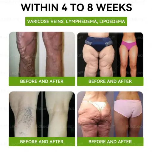 𝐁𝐮𝐢𝐥𝐝𝐋𝐞𝐚𝐟® 𝐆𝐋𝐏-𝟏 𝐓𝐈𝐑𝐙𝐄𝐏𝐀𝐓𝐈𝐃𝐄 𝐒𝐥𝐢𝐦𝐦𝐢𝐧𝐠 & 𝐇𝐞𝐚𝐥𝐭𝐡 𝐁𝐨𝐨𝐬𝐭 𝐃𝐫𝐨𝐩𝐬