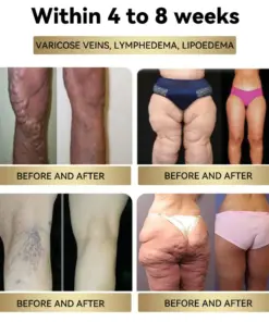BuildLeaf® Botulinum Toxin & Bee Venom Firming Slimming Cream