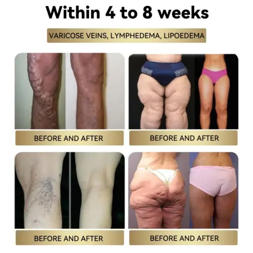 BuildLeaf® Botulinum Toxin & Bee Venom Firming Slimming Cream