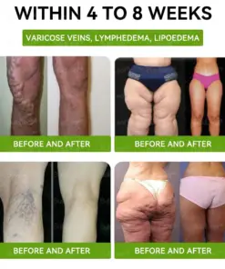 BuildLeaf® Tirzepatide GLP-1 Slimming & Health Boost Drops