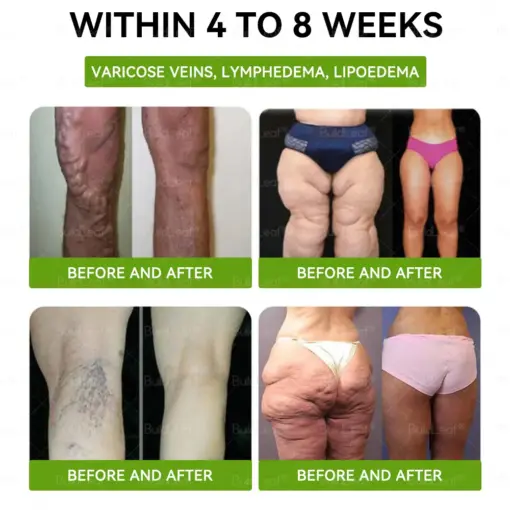 BuildLeaf® Tirzepatide GLP-1 Slimming & Health Boost Drops