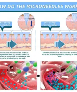 BuildLeaf® GLP-1 Nano-Microneedle Patch