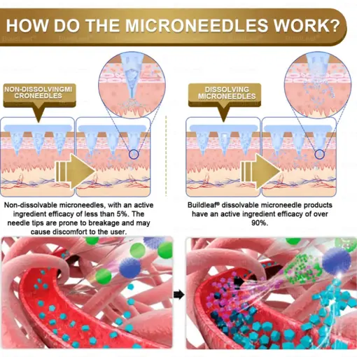 BuildLeaf® NIDDK-Tirzepatide Slimming & health NANO MICRONEEDLE PATCH