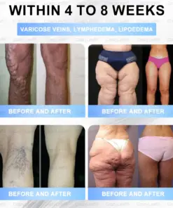 Buildleaf® Tirzepatide Slimming & Health Nano Microneedle Patch