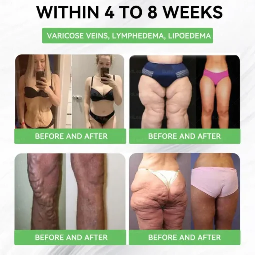 𝐁𝐮𝐢𝐥𝐝𝐋𝐞𝐚𝐟® 𝐆𝐋𝐏-𝟏 𝐏𝐫𝐨 𝐍𝐚𝐭𝐮𝐫𝐚𝐥 𝐇𝐞𝐚𝐥𝐭𝐡 𝐎𝐫𝐚𝐥 𝐒𝐨𝐥𝐮𝐭𝐢𝐨𝐧