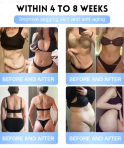 𝐁𝐮𝐢𝐥𝗱𝐋𝐞𝐚𝐟®𝐒𝐥𝐢𝐦 & 𝐅𝐢𝐫𝐦 𝐍𝐚𝐧𝐨 𝐌𝐢𝐜𝐫𝐨𝐧𝐞𝐞𝐝𝐥𝐞 𝐏𝐚𝐭𝐜𝐡