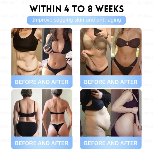 𝐁𝐮𝐢𝐥𝗱𝐋𝐞𝐚𝐟®𝐒𝐥𝐢𝐦 & 𝐅𝐢𝐫𝐦 𝐍𝐚𝐧𝐨 𝐌𝐢𝐜𝐫𝐨𝐧𝐞𝐞𝐝𝐥𝐞 𝐏𝐚𝐭𝐜𝐡