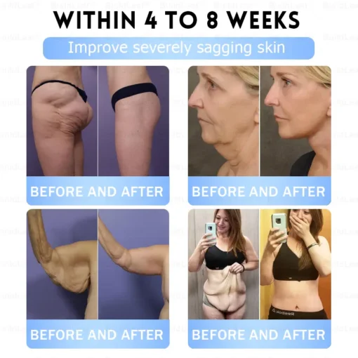 𝐁𝐮𝐢𝐥𝗱𝐋𝐞𝐚𝐟®𝐒𝐥𝐢𝐦 & 𝐅𝐢𝐫𝐦 𝐍𝐚𝐧𝐨 𝐌𝐢𝐜𝐫𝐨𝐧𝐞𝐞𝐝𝐥𝐞 𝐏𝐚𝐭𝐜𝐡