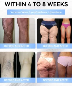 𝐁𝐮𝐢𝐥𝗱𝐋𝐞𝐚𝐟®𝐒𝐥𝐢𝐦 & 𝐅𝐢𝐫𝐦 𝐍𝐚𝐧𝐨 𝐌𝐢𝐜𝐫𝐨𝐧𝐞𝐞𝐝𝐥𝐞 𝐏𝐚𝐭𝐜𝐡