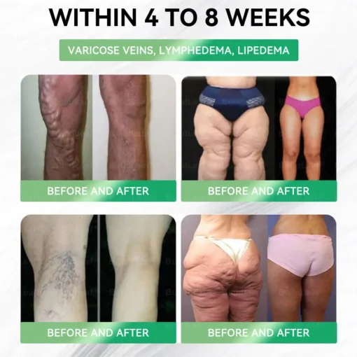 𝘽𝙪𝙞𝙡𝙙𝙇𝙚𝙖𝙛® 𝗚𝗟𝗣-𝟭 𝟐𝟎-𝐢𝐧-𝟏 𝐒𝐥𝐢𝐦 & 𝐇𝐞𝐚𝐥𝐭𝐡 𝐎𝐫𝐚𝐥 𝐒𝐨𝐥𝐮𝐭𝐢𝐨𝐧