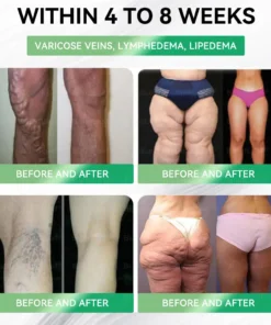 ๐ฝ๐ช๐๐ก๐๐๐๐๐ยฎ ๐๐๐ฃ-๐ญ๐๐-๐ถ๐ป-๐ญ ๐ฆ๐น๐ถ๐บ & ๐ฏ๐๐๐๐๐ ๐ถ๐๐๐ ๐บ๐๐๐๐๐๐๐